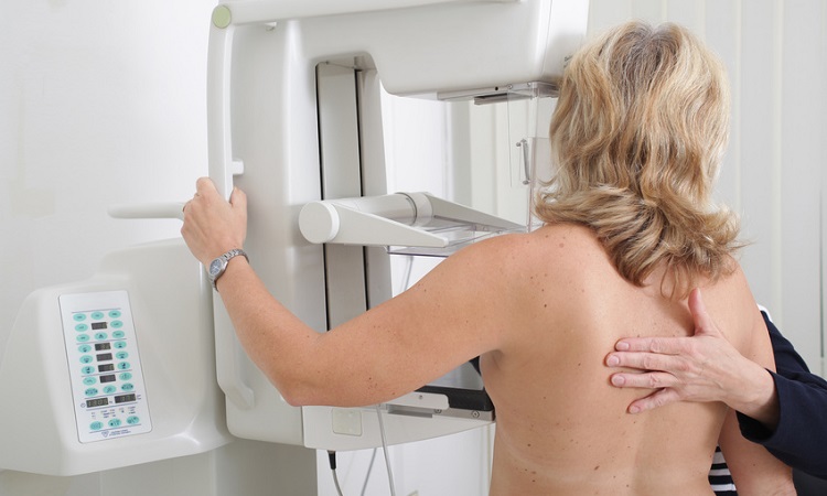 Frau bei einer Mammographie. 